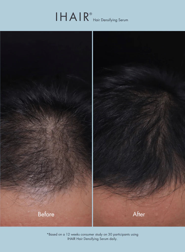 iHair ser pentru îndesirea parului